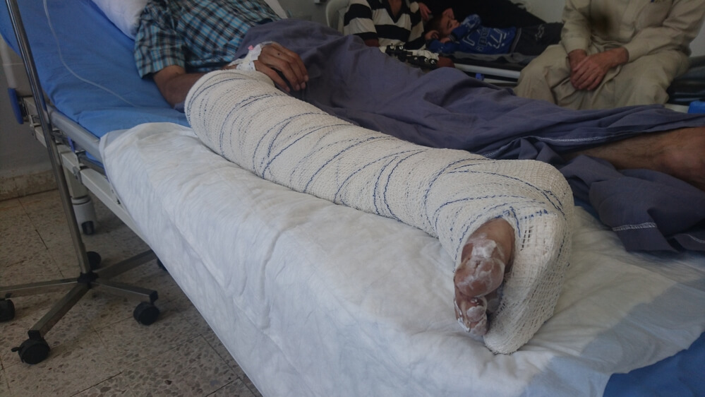 Hospital em Hassakeh recebe mais vítimas de ataques aéreos no norte da Síria