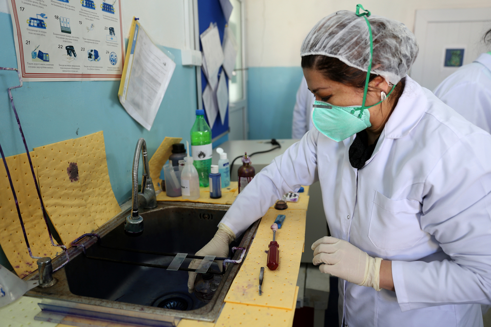 Técnico de laboratório de MSF analisa amostra de escarro no hospital nacional pediátrico de tuberculose em Dushanbe, no Tadjiquistão. (Foto: Joosarang Lee/MSF)