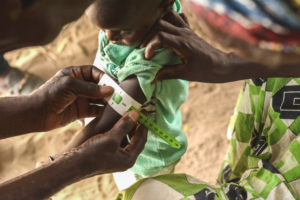 MSF atua para simplificar diagnóstico e tratamento da desnutrição no Níger