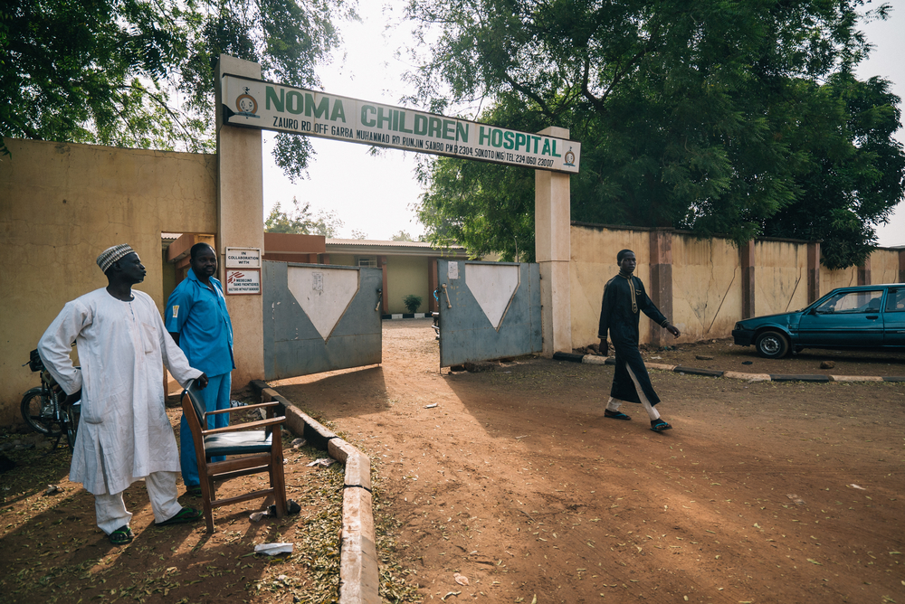 Conheça a história de Mulikat, uma sobrevivente do noma na Nigéria