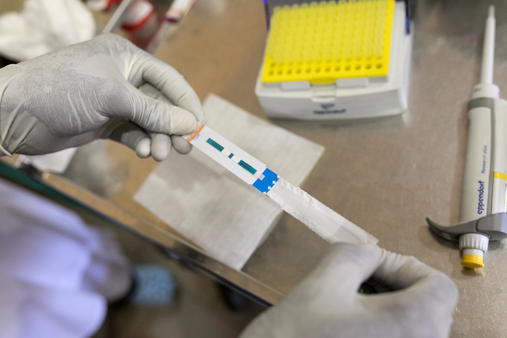 Tuberculose: novos testes e medicamentos seguem fora do alcance de muitos pacientes