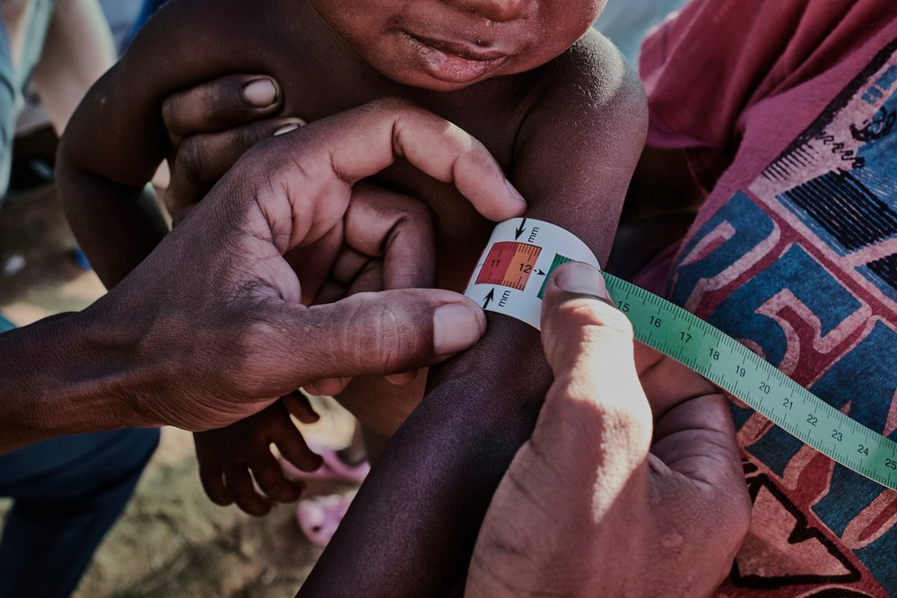 A desnutrição ameaça a população de algumas regiões de Madagascar
