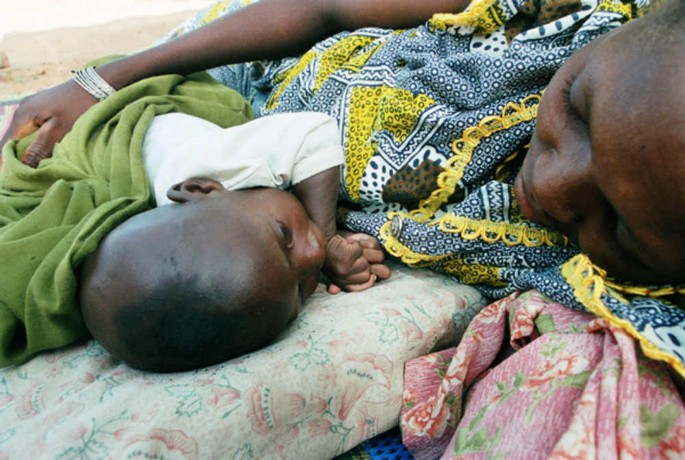  Em agosto, o Níger adota um protocolo nacional para o tratamento da desnutrição aguda grave com base no uso de alimento terapêutico pronto para o uso, permitindo que crianças recebam o tratamento de forma ambulatorial – sem precisar de internação. Graças à nova estratégia, o tratamento da desnutrição aguda grave é ampliado massivamente. Os dados de 2005 são completamente sem precedentes: 69.627 crianças tratadas no Níger, sendo 40 mil delas em programas de MSF.