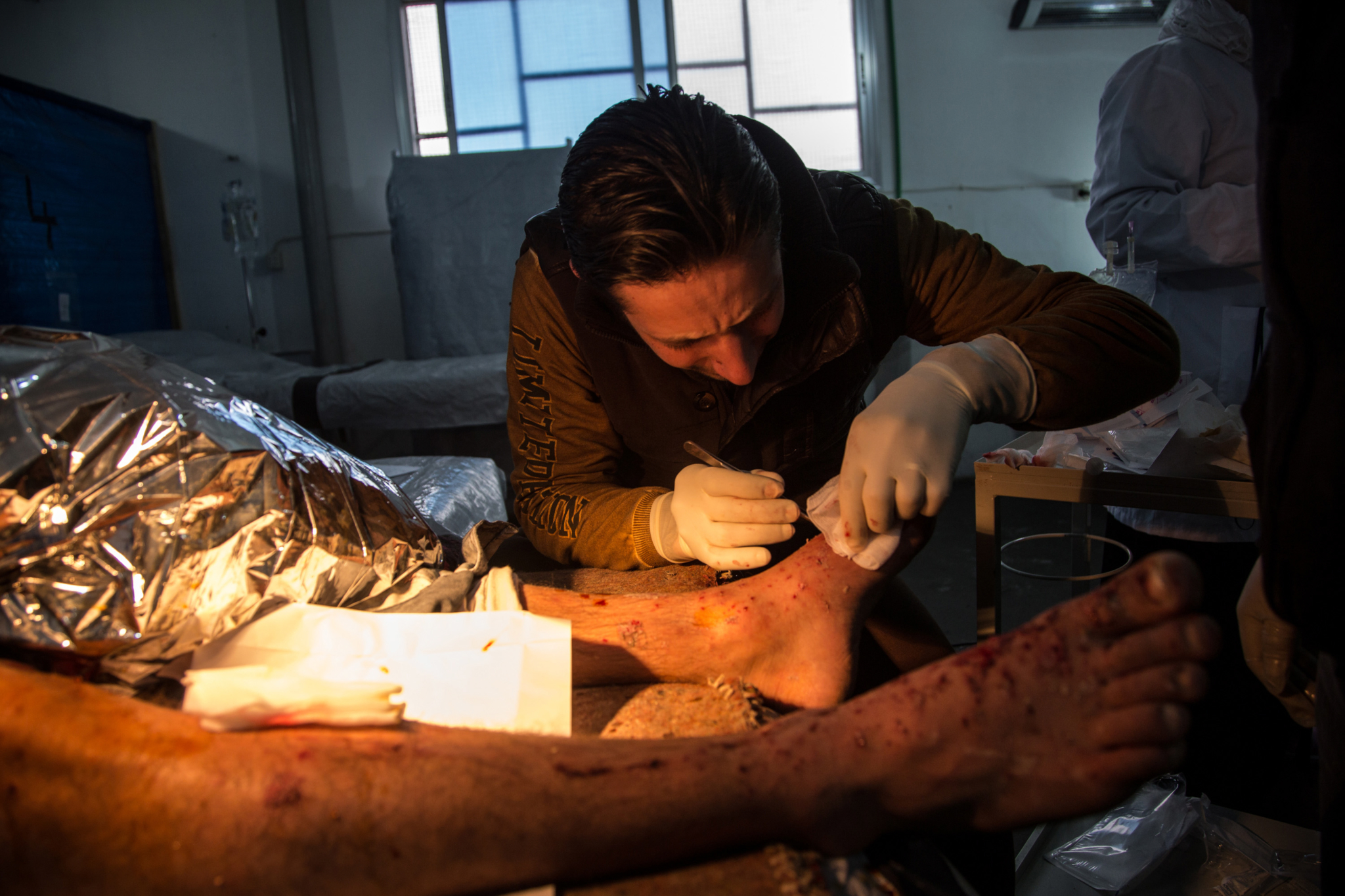 Um enfermeiro sírio cuida de dezenas de pequenos ferimentos de um paciente no hospital de MSF, no norte da Síria. A pessoa foi ferida por estilhaços de uma granada após a explosão de um tanque próximo de onde ela estava.