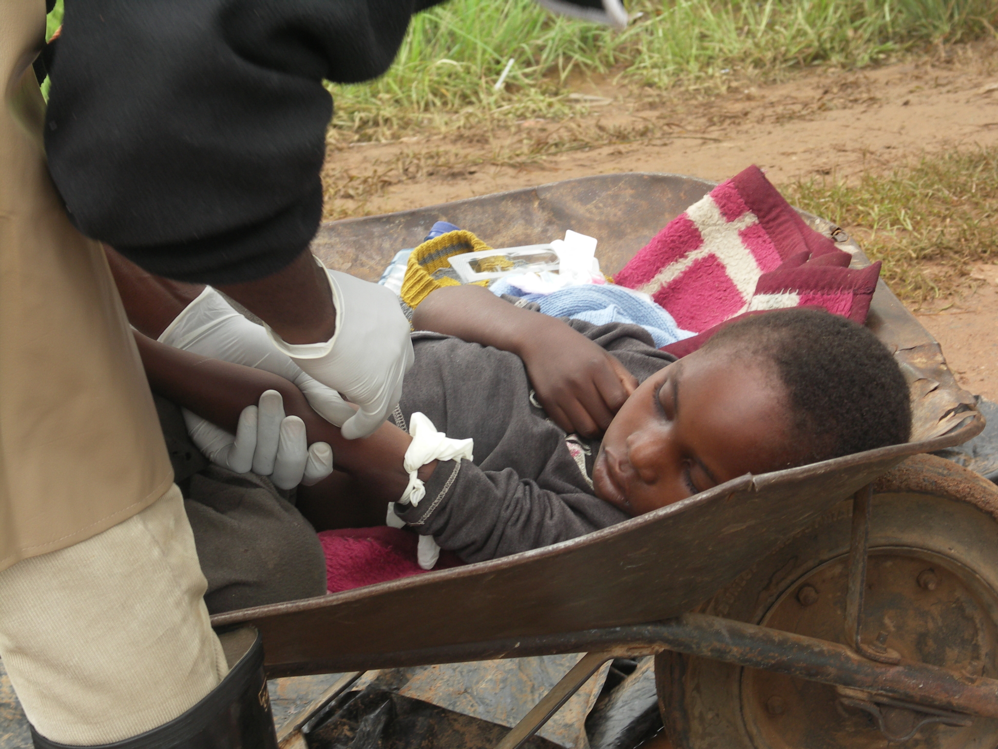 Pacientes com cólera se desidratam e morrem rapidamente. Esse menino foi trazido em um carrinho-de-mão ao Centro de Tratamento de Cólera de Kadoma.Desidratado, precisou tomar soro antes ir para a maca.