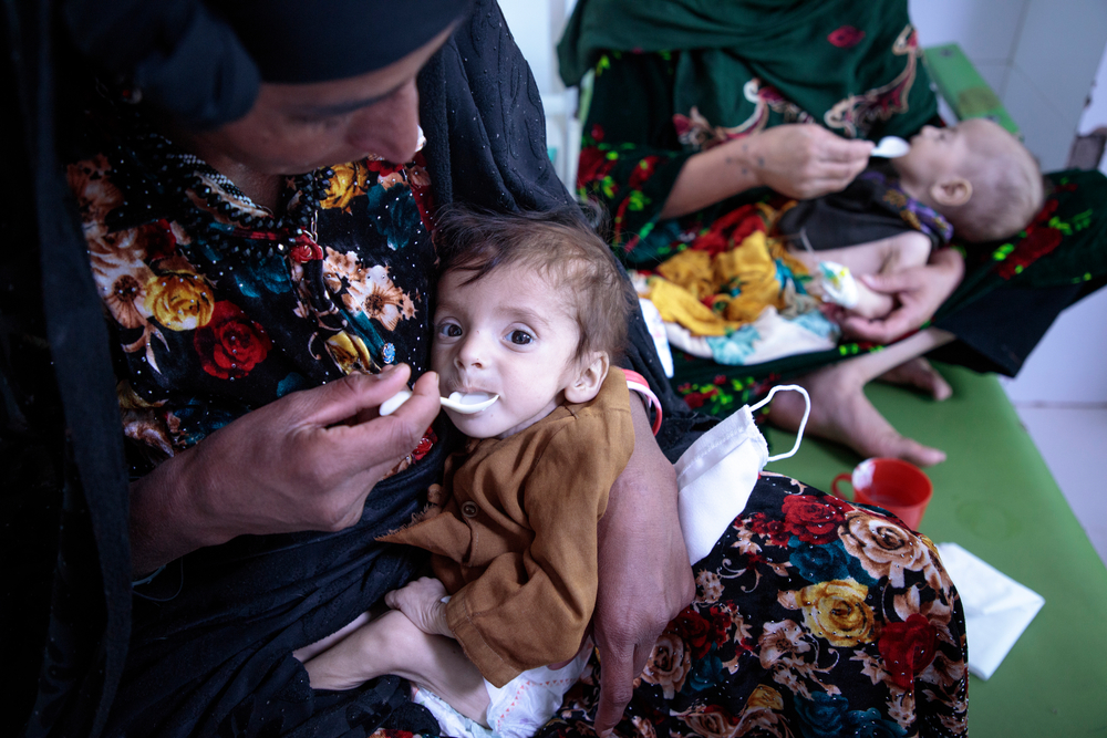 MSF tem observado um grande número de crianças desnutridas em seu centro de alimentação hospitalar em Herat, com um aumento de quase 40% no número de admissões entre maio e setembro de2021, em relação ao mesmo período do ano anterior. Afeganistão, outubro de 2021.