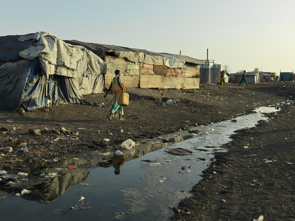 Appalling sanitation conditions in Bentiu internally displaced persons camp are leading to outbreaks of waterborne diseases, including hepatitis E.

The outbreaks are the consequence of appalling living conditions, including a lack of access to adequate water, sanitation and hygiene. 

In 2021, extreme flooding and new influxes of displaced people exacerbated already deplorable living conditions.