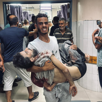 Abdullah Hammad, que trabalhou com MSF em Gaza, é carregado para o hospital Nasser após ataque das forças israelenses contra pessoas que tentavam coletar alimentos dos caminhões de ajuda. Gaza, 3 de julho de 2025. ©Mohammad Salama