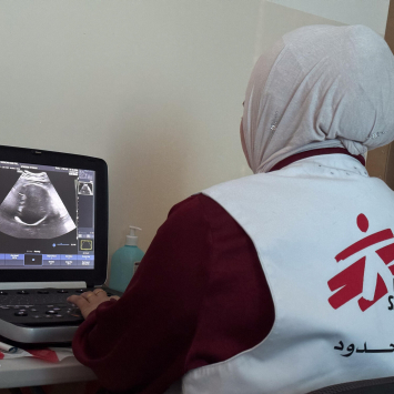 Profissional de MSF analisa uma ecografia durante atividades em uma clínica móvel em Khallet Al-Mai, Hebron, na Cisjordânia. Palestina, julho de 2026. ©Oday Alshobaki/MSF