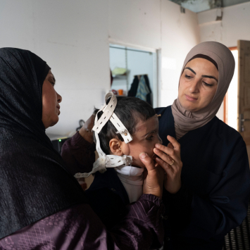 Joud, de 4 anos de idade, vítima de queimaduras, recebe sua máscara 3D na clínica de MSF na Cidade de Gaza. ©Nour Alsaqqa/MSF