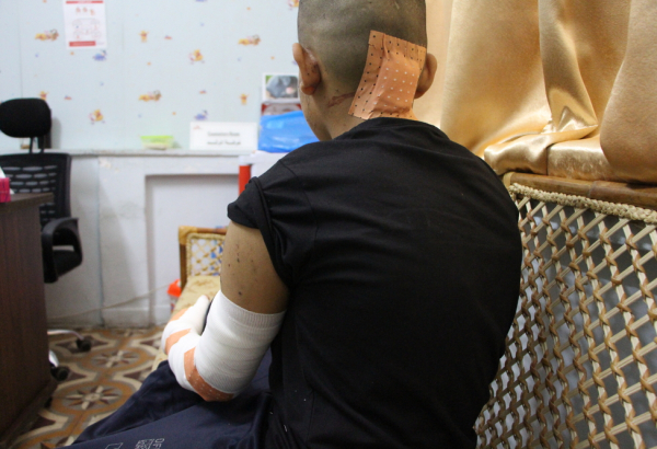 Wael, 13 anos de idade, após seus curativos serem trocados pelas equipes de MSF em Gaza. Palestina, agosto de 2022. Foto: MSF
