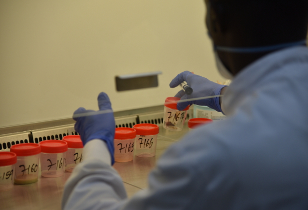 Amostras para diagnóstico em hospital de Makeni. Serra Leoa, dezembro de 2023. © MSF/Ammar Obeidat