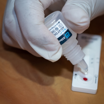 Equipes de MSF estão trabalhando na detecção e diagnóstico de casos. © Abir Abdullah/MSF