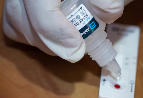 Equipes de MSF estão trabalhando na detecção e diagnóstico de casos. © Abir Abdullah/MSF