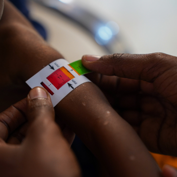 Profissional mede braço de bebê com o MUAC, uma fita que ajuda a diagnosticar a desnutrição. © Bishar Mayow/MSF