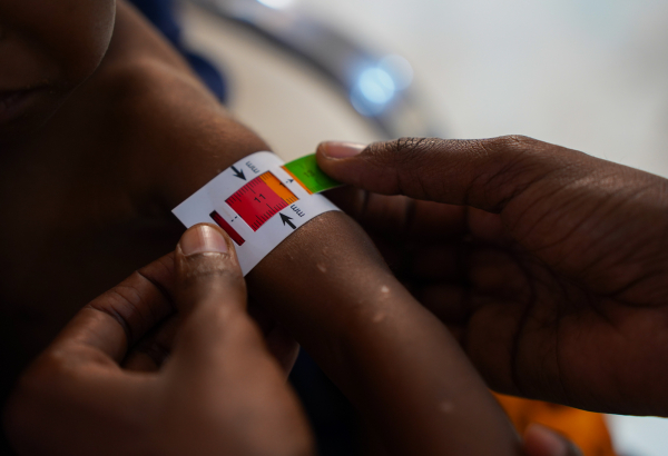 Profissional mede braço de bebê com o MUAC, uma fita que ajuda a diagnosticar a desnutrição. © Bishar Mayow/MSF