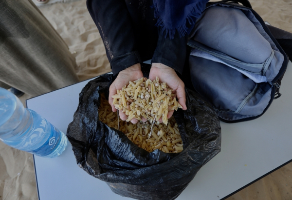 Samah Hamdan, uma mulher palestina deslocada que recebe cuidados na clínica de Mawasi, após arriscar a vida por um punhado de comida. Faixa de Gaza, 19 de junho de 2025. ©Nour Alsaqqa/MSF