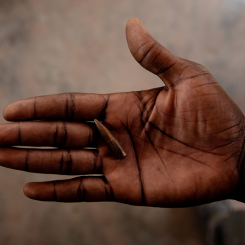 Foto:Adrienne Surprenant/Collectif Item for MSF /2021
