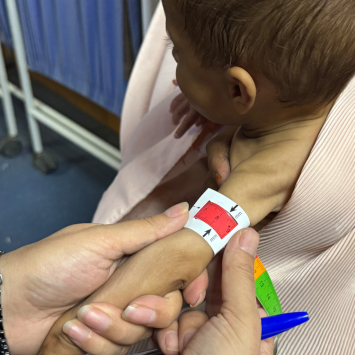 Enfermeira mede a circunferência do braço (MUAC) de um bebê no centro ambulatório de alimentação terapêutica de MSF, no sul do Afeganistão. 
©Nazia Kamal/MSF