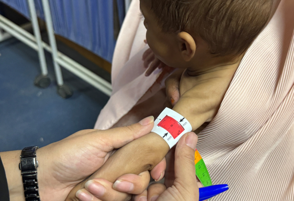 Enfermeira mede a circunferência do braço (MUAC) de um bebê no centro ambulatório de alimentação terapêutica de MSF, no sul do Afeganistão. 
©Nazia Kamal/MSF