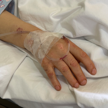 Mãos de Jamila, profissional de saúde ferida em ataque israelense que atingiu o Hospital Jabal Amel em 1º de junho de 2026, no Líbano. © Kristen Poels
