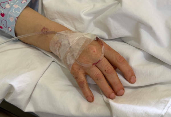 Mãos de Jamila, profissional de saúde ferida em ataque israelense que atingiu o Hospital Jabal Amel em 1º de junho de 2026, no Líbano. © Kristen Poels