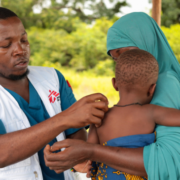 O enfermeiro Helder Torres realiza consultas pediátricas em Olumbe, uma comunidade onde clínicas móveis de MSF oferecem cuidados médicos a pessoas com acesso limitado a serviços de saúde. ©MSF