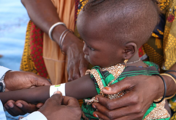 MSF inicia programa nutricional de emergência no Chade