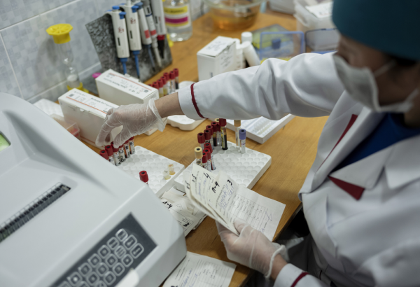 Empresa de diagnóstico Cepheid cobra quatro vezes mais do que deveria pelos testes de COVID-19