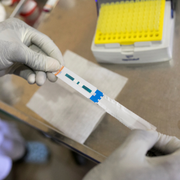 Tuberculose: novos testes e medicamentos seguem fora do alcance de muitos pacientes