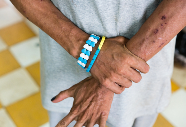 MSF lamenta impedimento à distribuição do sofosbuvir a pacientes graves e mantém defesa do amplo acesso à cura da hepatite C