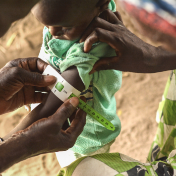 MSF atua para simplificar diagnóstico e tratamento da desnutrição no Níger