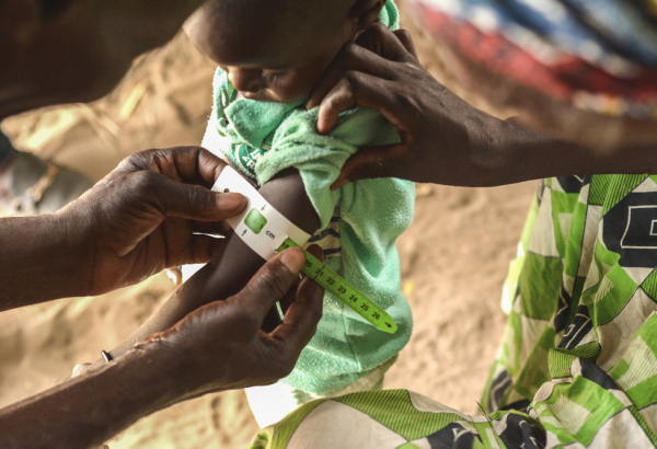 MSF atua para simplificar diagnóstico e tratamento da desnutrição no Níger