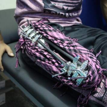 Lesões em Gaza ameaçam deixar vidas permanentemente destruídas