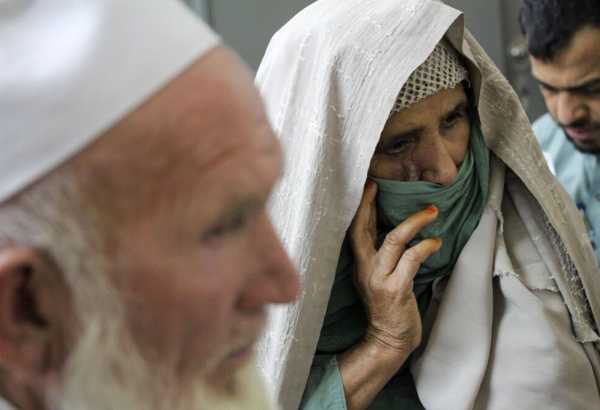 A única opção para o tratamento da leishmaniose cutânea em Khyber Pakhtunkhwa