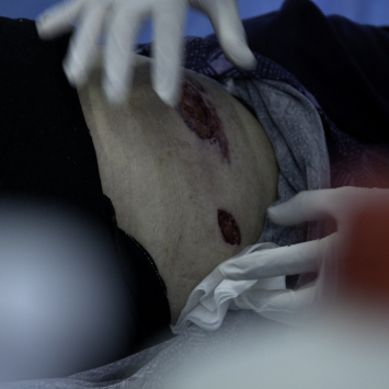 siria-bombardeio-ataque-msf