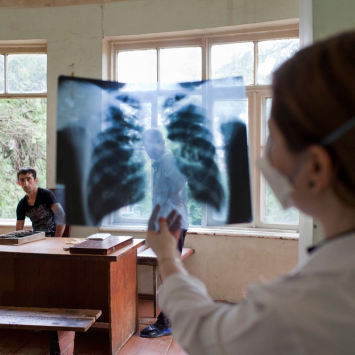 MSF divulga dados preliminares sobre uso de novos medicamentos contra a tuberculose:
