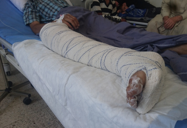 Hospital em Hassakeh recebe mais vítimas de ataques aéreos no norte da Síria